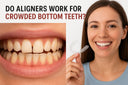Do Aligners Work for Crowded Bottom Teeth?