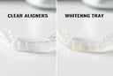 Aligners vs Whitening Kits: Which Comes First?