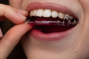 Putting on hawley retainers 