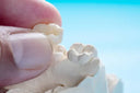 Close-up zirconia crown on molar tooth model
