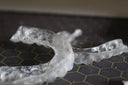 Retainers side by side with wear-and-tear visuals.