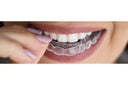 Night Guards for Teeth Grinding Explained