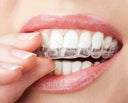 Retainers-Gum-Health-What-to-Watch-For NewSmile™ USA