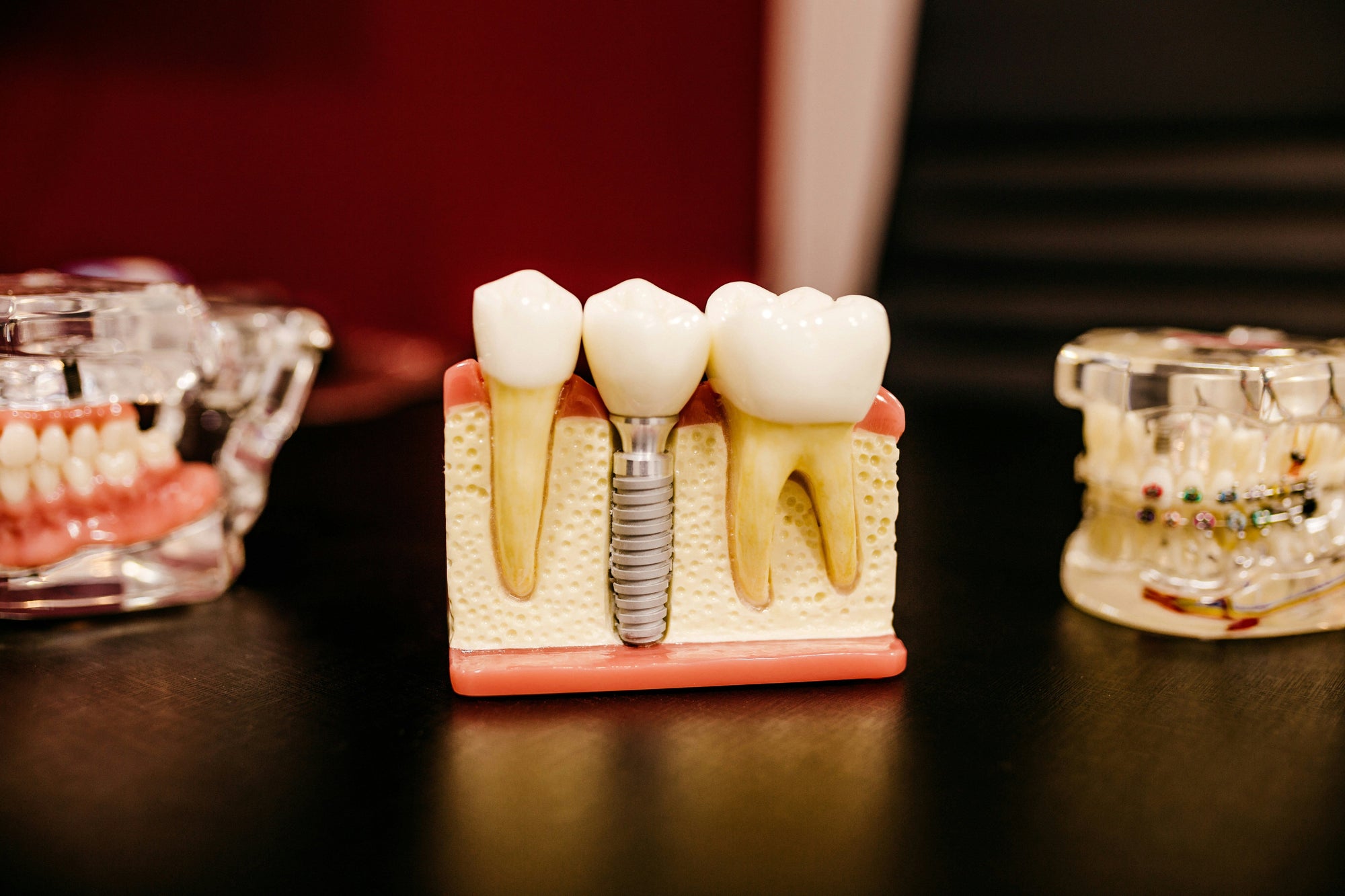 Beyond Straight Teeth: The Hidden Benefits of Clear Aligners