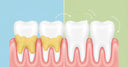Water Flossers for Bad Breath: Can They Really Help Freshen Your Breath?