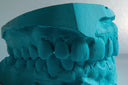 Top Benefits of Clear Aligners: A Modern Way to Straighten Your Teeth
