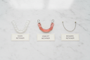 Different types of retainers: clear retainers, Hawley retainers, bonded retainers