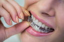 Clear Night Guards for Teeth Grinding Relief