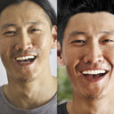 Affordable clear aligners and retainers | NewSmile clear aligners for less!