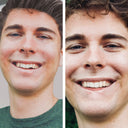 Invisible braces for teeth straightening | Clear teeth aligners and whitening foam | NewSmile