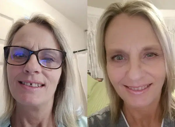 Satisfied customer Brenda showing off her new smile with NewSmile