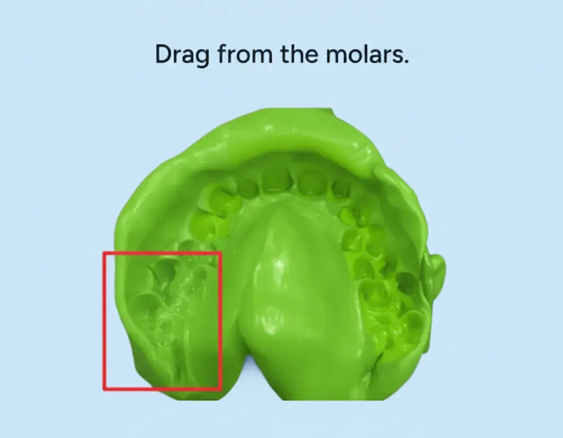Yellow model with green putty in molar teeth on a blue background