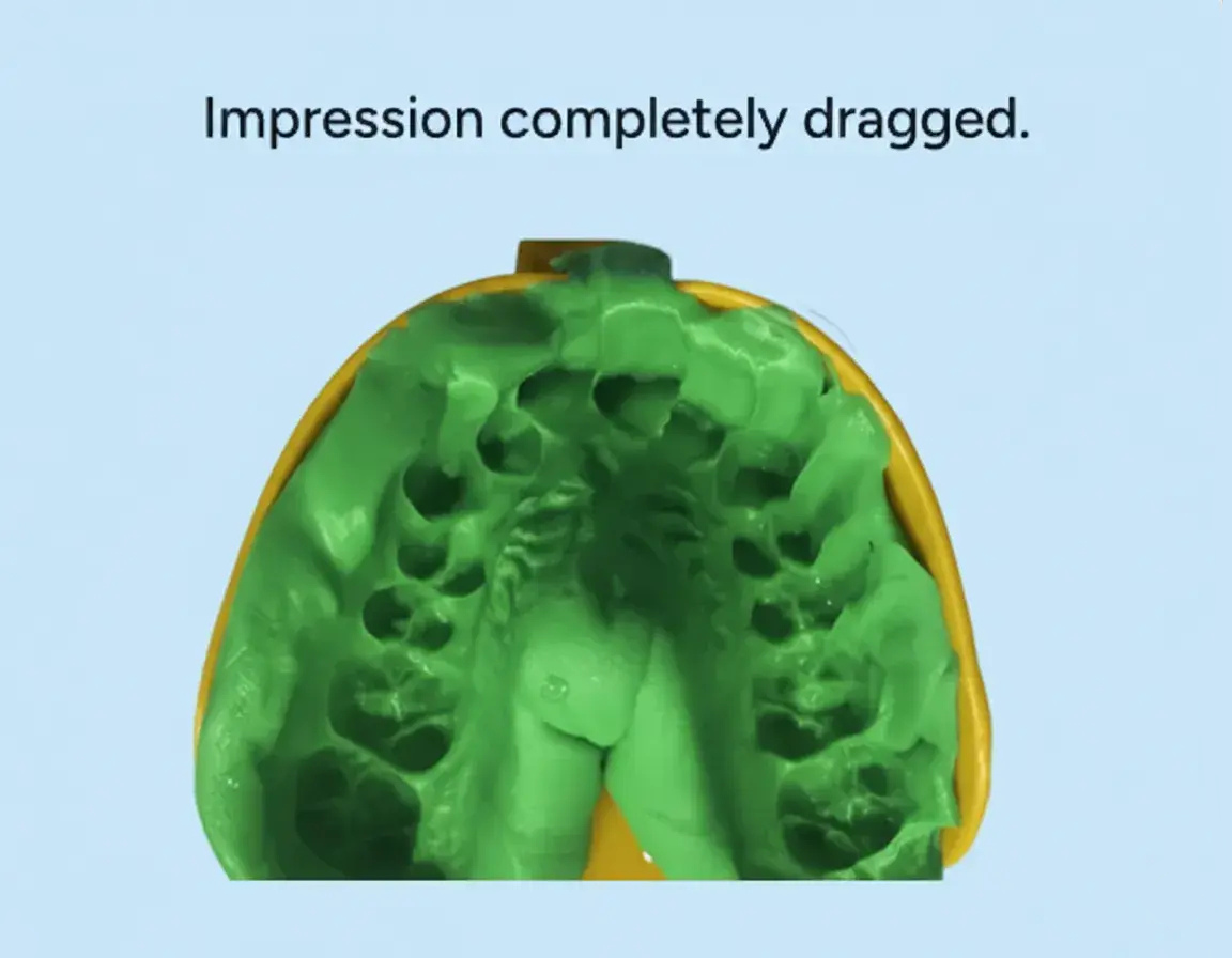 Green putty in a yellow impression mold on a blue background with text 'Impression completely dragged.'