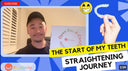 Norman's Teeth Straightening Review Of NewSmile Clear Aligners
