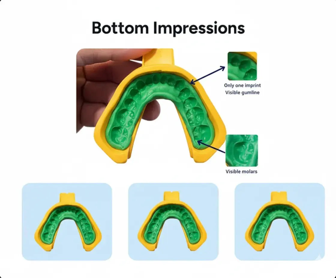 Dental impression tray with green impression material, labeled 'Bottom Impressions'.