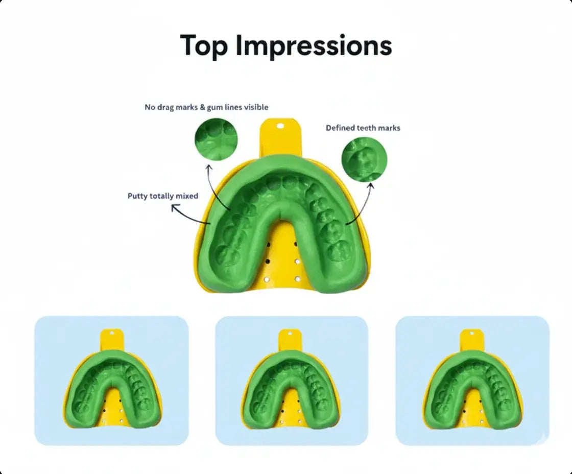 Dental impression tray with green putty showing top impressions on a white background.